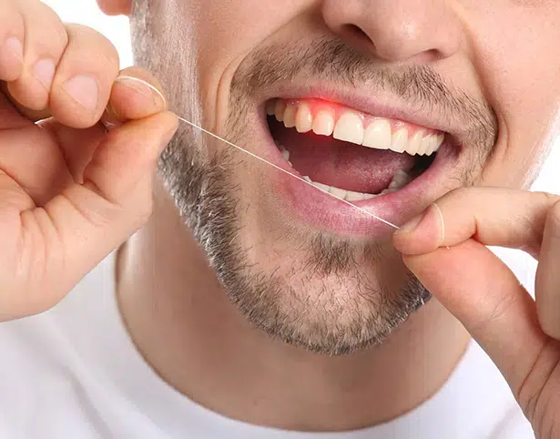 periodontal disease treatment in union - duo dental group