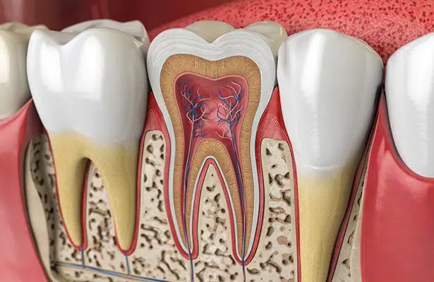 root canal treatment in union - duo dental group