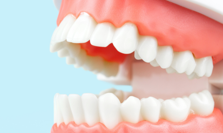 Top Surprising Professional Teeth Whitening Benefits Over Home-Kits