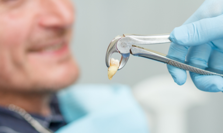 Essential Wisdom Teeth Removal After-Care Tips For A Smooth Recovery